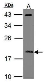 ARF3 Antibody in Western Blot (WB)