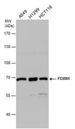 FOXN1 Antibody in Western Blot (WB)