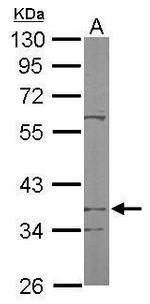 PDSS2 Antibody in Western Blot (WB)