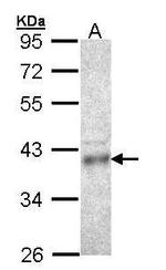 CPOX Antibody in Western Blot (WB)