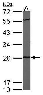 PSMA6 Antibody in Western Blot (WB)