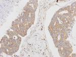 MSTO1 Antibody in Immunohistochemistry (Paraffin) (IHC (P))