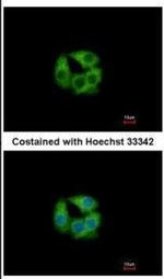 PCCB Antibody in Immunocytochemistry (ICC/IF)