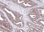 PCCB Antibody in Immunohistochemistry (Paraffin) (IHC (P))