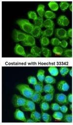 C2 Antibody in Immunocytochemistry (ICC/IF)