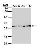 C2 Antibody in Western Blot (WB)