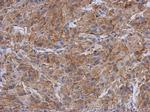 Radixin Antibody in Immunohistochemistry (Paraffin) (IHC (P))