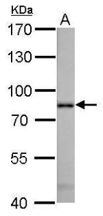 Radixin Antibody in Western Blot (WB)