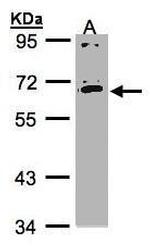 IL17RC Isoform 1 Precursor Antibody in Western Blot (WB)