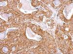 NDUFB9 Antibody in Immunohistochemistry (Paraffin) (IHC (P))