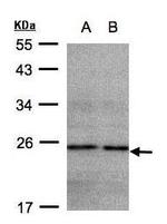 NDUFB9 Antibody in Western Blot (WB)