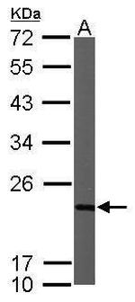 NDUFB9 Antibody in Western Blot (WB)