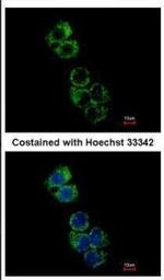 GSTA2 Antibody in Immunocytochemistry (ICC/IF)