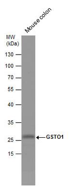 GST Omega 1 140A Antibody in Western Blot (WB)