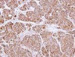 Bcl-X Antibody in Immunohistochemistry (Paraffin) (IHC (P))