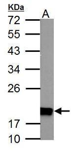 NDUFS4 Antibody in Western Blot (WB)