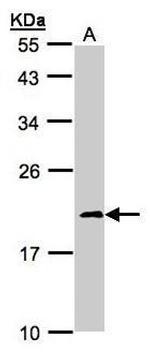 NDUFS4 Antibody in Western Blot (WB)