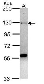 ZNF574 Antibody in Western Blot (WB)