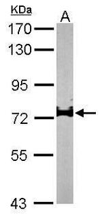 IL17RD Antibody in Western Blot (WB)