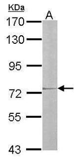 IL17RD Antibody in Western Blot (WB)