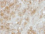 PFKL Antibody in Immunohistochemistry (Paraffin) (IHC (P))