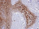 WBSCR22 Antibody in Immunohistochemistry (Paraffin) (IHC (P))