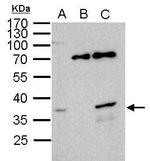 WBSCR22 Antibody in Immunoprecipitation (IP)