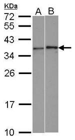 WBSCR22 Antibody in Western Blot (WB)