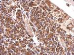 MDH2 Antibody in Immunohistochemistry (Paraffin) (IHC (P))