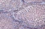 MDH2 Antibody in Immunohistochemistry (Paraffin) (IHC (P))