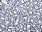 MDH2 Antibody in Immunohistochemistry (Paraffin) (IHC (P))