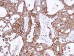 PANK1 Antibody in Immunohistochemistry (Paraffin) (IHC (P))