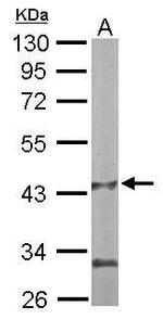 PANK1 Antibody in Western Blot (WB)