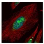 UTP6 Antibody in Immunocytochemistry (ICC/IF)