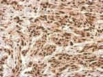 UTP6 Antibody in Immunohistochemistry (Paraffin) (IHC (P))