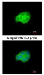 HSPA6 Antibody in Immunocytochemistry (ICC/IF)