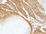 HSPA6 Antibody in Immunohistochemistry (Paraffin) (IHC (P))