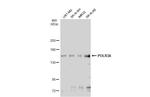 POLR3A Antibody in Western Blot (WB)