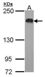 USP47 Antibody in Western Blot (WB)