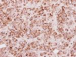 TST Antibody in Immunohistochemistry (Paraffin) (IHC (P))