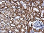 TST Antibody in Immunohistochemistry (Paraffin) (IHC (P))