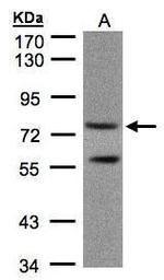 PDE4C Antibody in Western Blot (WB)