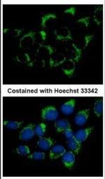 CMG1 Antibody in Immunocytochemistry (ICC/IF)