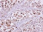 KPNA2 Antibody in Immunohistochemistry (Paraffin) (IHC (P))