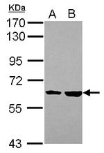 KPNA4 Antibody in Western Blot (WB)