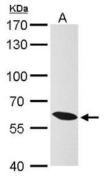 KPNA4 Antibody in Western Blot (WB)