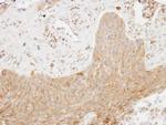 SKAP2 Antibody in Immunohistochemistry (Paraffin) (IHC (P))