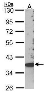 SKAP2 Antibody in Western Blot (WB)