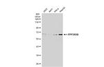 PPP2R5B Antibody in Western Blot (WB)