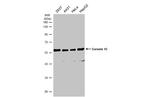 Coronin 3 Antibody in Western Blot (WB)